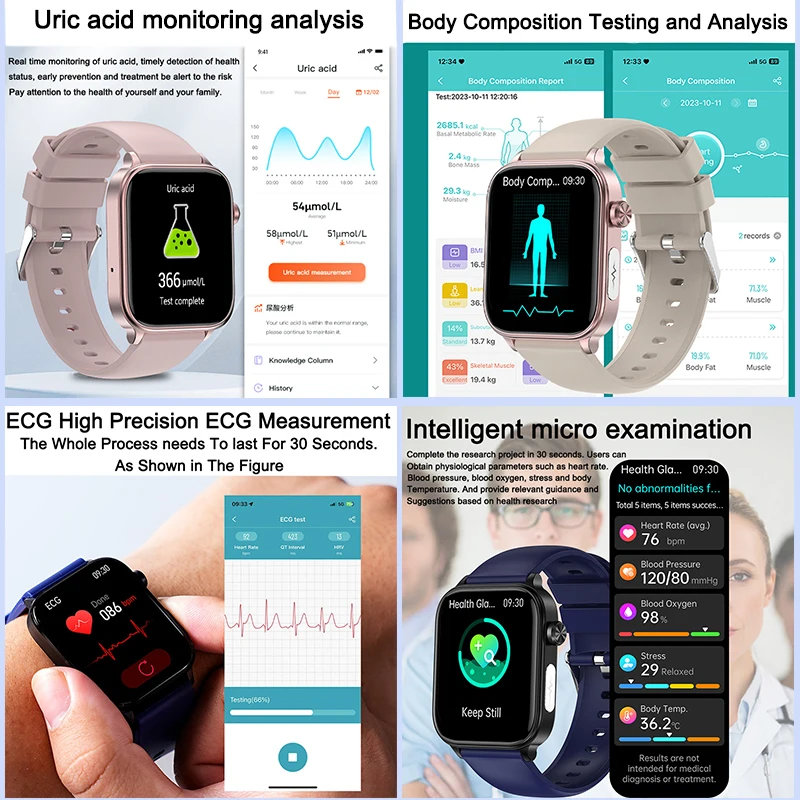2025 New ECG+PPG Monitoring Sm - Smartwatch New Watches For Women reseña y precio